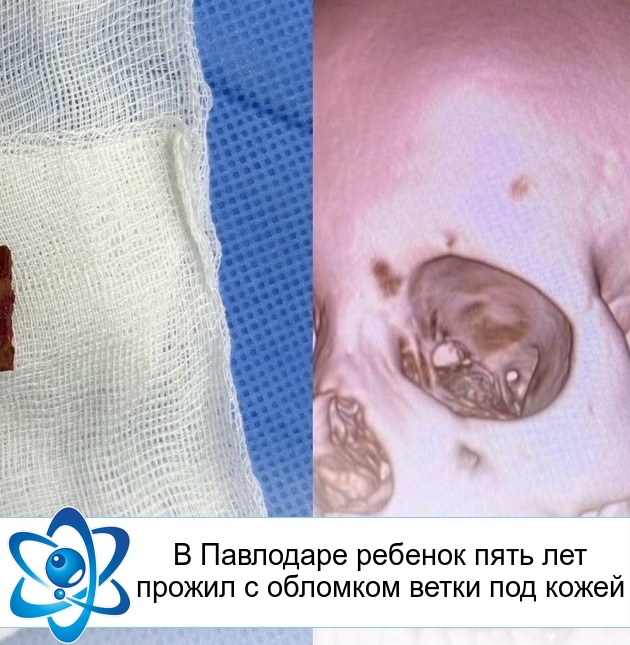 � ��������� ������� ���� ��� ������ � �������� ����� ��� �����