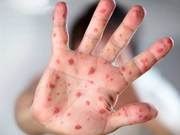 � ���������� ������� ����� 40 ������� �������� �����: ������� � ����������