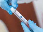 ����������� �� �������: �� ����� ������� ��� 92 ����������