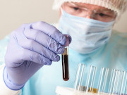 90 ����� ���������� ������������� ������� � ����������: ������ �� ���� 28 ������