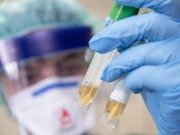 �������������� ��� ������� � 1,7 ���� �� ����������