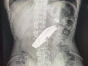 ��� � ��������� ��������� ��������� �� ������ ����������