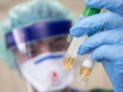 � ������������ ������� ��� ����� ������ ��������� �� �OVID-19