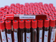 ��� ����� ���� � ������������� ������ � ������� ������� ����������