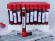 ��������� ������ ���� �������� COVID-19 - ��������