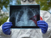 ������� ���������� �� ��� ����� ������, ��� ��������� � ��VID-19 � ������������ �������