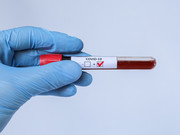 ������ 11 ����� ������� �������������� ���������� ������� � 1 ������� � ����������