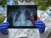 ������������ ������� ��������� ��������� ���� �� COVID-19