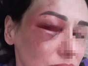 ������� ���������� ��������� �������� � ��������������