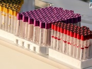 ������� � ��������� ���-��������������, ���������� ������