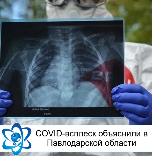 COVID-������� ��������� � ������������ �������